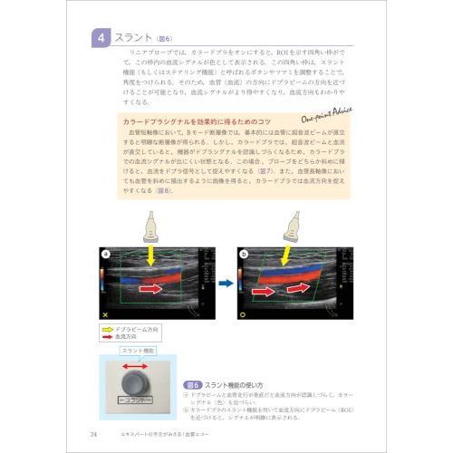 Amazon.co.jp: 画像から読み解く 血管エコー 決め手の一枚: 読め