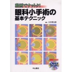 眼科小手術の基本テクニック　動画でナットク！