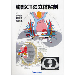 胸部ＣＴの立体解剖