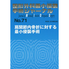 整形外科最小侵襲手術ジャーナル　Ｎｏ．７１　肩関節内骨折に対する最小侵襲手術