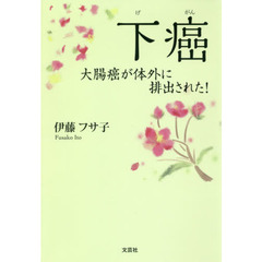 下癌　大腸癌が体外に排出された！