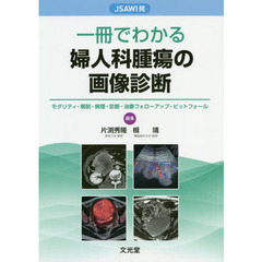 ＪＳＡＷＩ発一冊でわかる婦人科腫瘍の画像診断　モダリティ・解剖・病理・診断・治療フォローアップ・ピットフォール