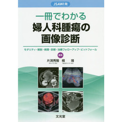 ＪＳＡＷＩ発一冊でわかる婦人科腫瘍の画像診断　モダリティ・解剖・病理・診断・治療フォローアップ・ピットフォール