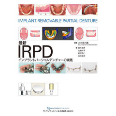 最新ＩＲＰＤインプラントパーシャルデンチャーの実践