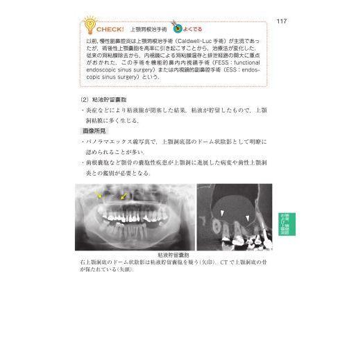 歯科国試パーフェクトマスター歯科放射線学
