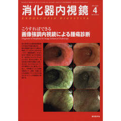 消化器内視鏡　Ｖｏｌ．２３Ｎｏ．４（２０１１Ａｐｒｉｌ）　こうすればできる画像強調内視鏡による腫瘍診断