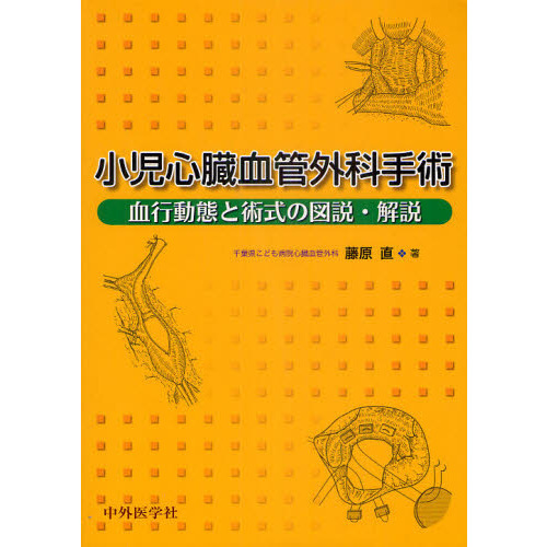 小児心臓血管外科手術　血行動態と術式の図説・解説