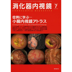 消化器内視鏡　Ｖｏｌ．２５Ｎｏ．７（２０１３Ｊｕｌｙ）　症例に学ぶ－小腸内視鏡アトラス