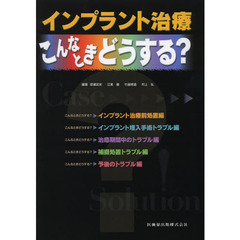 インプラント治療こんなときどうする？