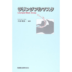 ラリンジアルマスク