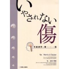 いやされない傷　児童虐待と傷ついていく脳