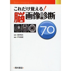 これだけ覚える！脳画像診断７０