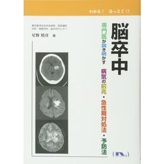 脳卒中　専門医が説き明かす病気の前兆・急性期対処法・予防法