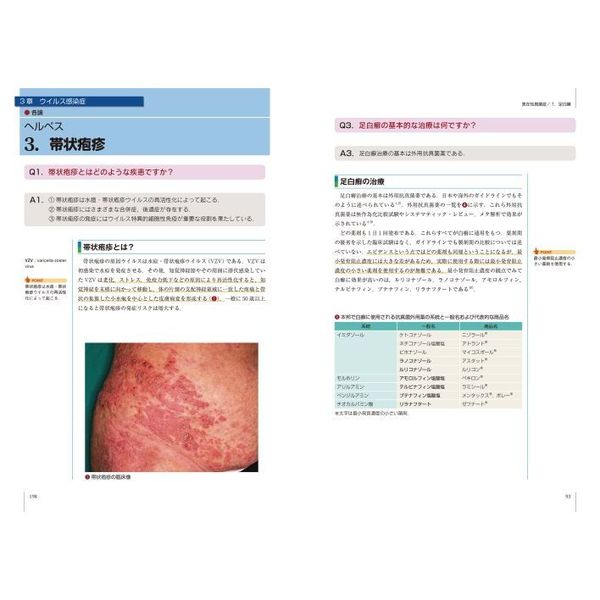 エビデンスに基づくQ＆Aでわかる皮膚感染症治療 通販｜セブン