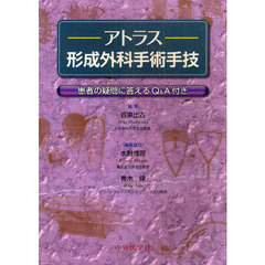 アトラス形成外科手術手技　患者の疑問に答えるＱ＆Ａ付き