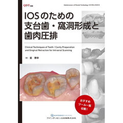 ＩＯＳのための支台歯・窩洞形成と歯肉圧排