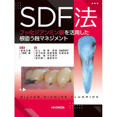 ＳＤＦ法－フッ化ジアンミン銀を活用した根