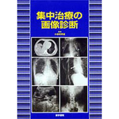 集中治療の画像診断