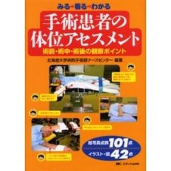 みる　看る　わかる　手術患者の体位アセスメント　術前・術中・術後の観察ポイント