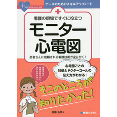 看護の現場ですぐに役立つモニター心電図　患者さんに信頼される看護技術が身に付く！