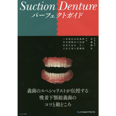 Ｓｕｃｔｉｏｎ　Ｄｅｎｔｕｒｅパーフェクトガイド
