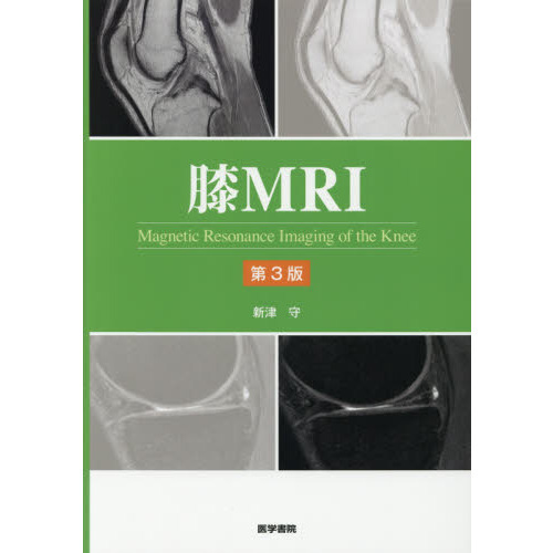 膝ＭＲＩ　第３版