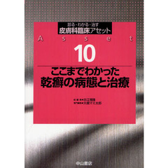 皮膚科臨床アセット　診る・わかる・治す　１０　ここまでわかった乾癬の病態と治療