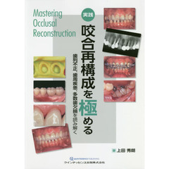 実践咬合再構成を極める　歯列不正、歯周疾患、多数歯欠損を読み解く