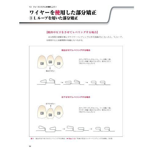 数量限定】 ZERO イラストと症例で学ぶ開業医のための臨床部分矯正 