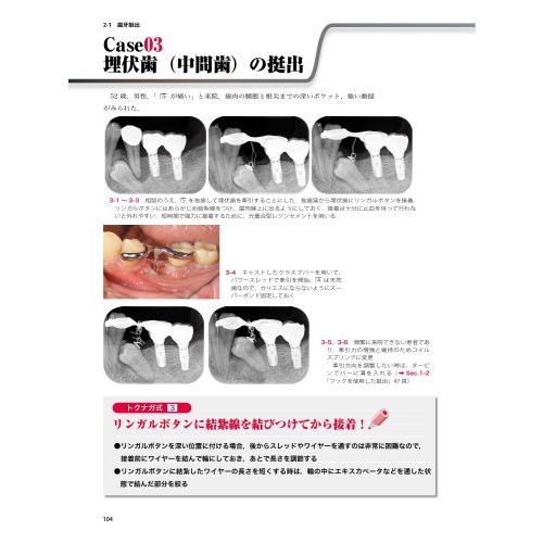 イラストと症例で学ぶ開業医のための臨床部分矯正　咬合育成から補綴前矯正まで