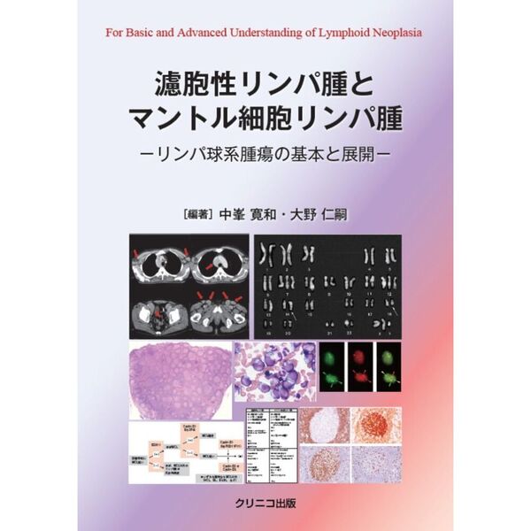 濾胞 性 リンパ腫の画像