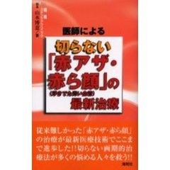 医師による切らない「赤アザ・赤ら顔〈浮きでた青い血管〉」の最新治療