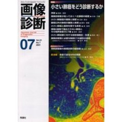 画像診断　Ｖｏｌ．２１Ｎｏ．７　特集小さい肺癌をどう診断するか