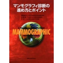 マンモグラフィ診断の進め方とポイント