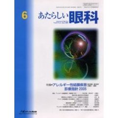 あたらしい眼科　Ｖｏｌ．２２Ｎｏ．６（２００５Ｊｕｎｅ）　特集・アレルギー性結膜疾患診療指針２００５