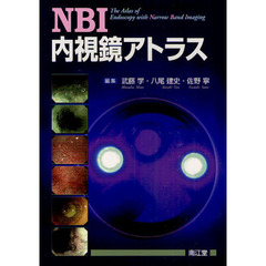 ＮＢＩ内視鏡アトラス