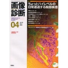 画像診断　Ｖｏｌ．２５Ｎｏ．４　特集ちょっとハイレベルの日常遭遇する胸部疾患