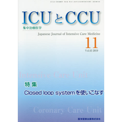 closed loopの画像