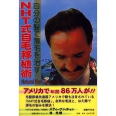 ＮＨＴ式自毛移植術　自分の髪で薄毛を治す