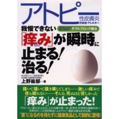 我慢できない「痒み」が瞬時に止まる！治る！　アトピー性皮膚炎・花粉症・アレルギー　体の内と外から根こそぎ治すダブルブロック療法