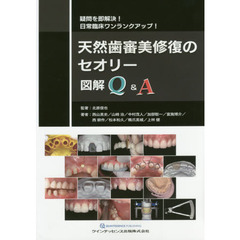 天然歯審美修復のセオリー図解Ｑ＆Ａ　疑問を即解決！日常臨床ワンランクアップ！