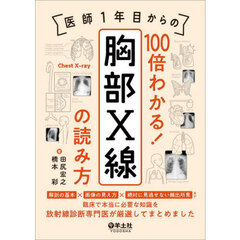 医師１年目からの１００倍わかる！胸部Ｘ線の読み方　解剖の基本×画像の見え方×絶対に見逃せない頻出所見まで臨床で本当に必要な知識を放射線診断専門医が厳選してまとめました