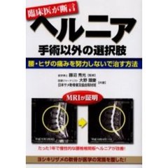 ヘルニア手術以外の選択肢　腰・ヒザの痛みを努力しないで治す方法　臨床医が断言