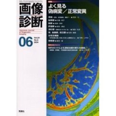 画像診断　Ｖｏｌ．２４Ｎｏ．６　特集よく見る偽病変／正常変異