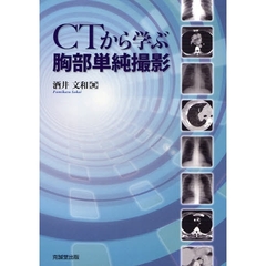 ＣＴから学ぶ胸部単純撮影