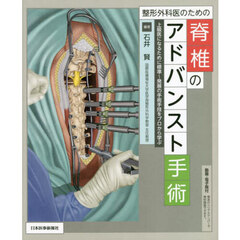 整形外科医のための脊椎のアドバンスト手術