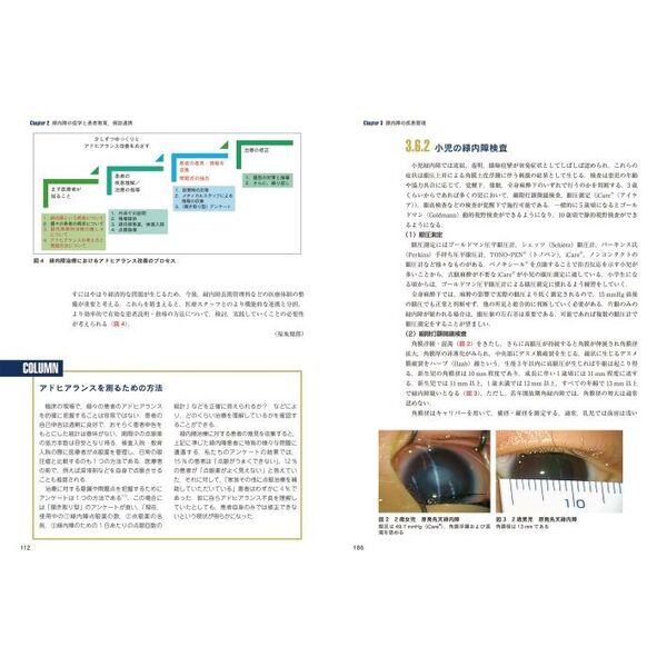 眼科診療エクレール　１　最新緑内障診療パーフェクトガイド　患者教育から最新の手術治療まで