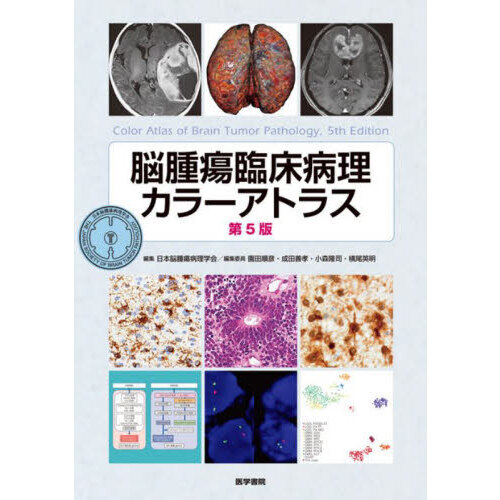 脳腫瘍臨床病理カラーアトラス 第５版 通販｜セブンネットショッピング
