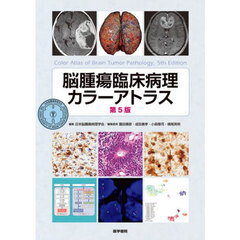 脳腫瘍臨床病理カラーアトラス　第５版