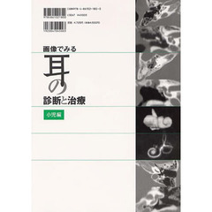 画像でみる耳の診断と治療　小児編